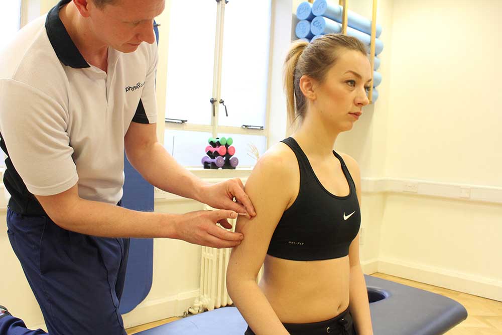 Specialist physiotherapist applying accupuncture to relieve symptoms of pain
